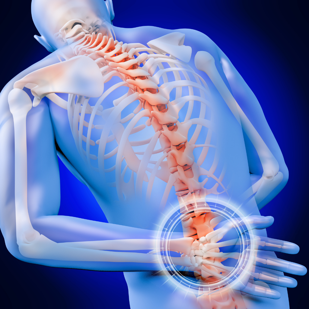 THERAPY FOR BACK PAIN